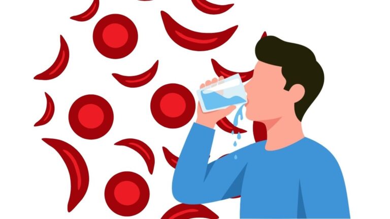 Hyperhydratie tijdens sikkelcelcrise